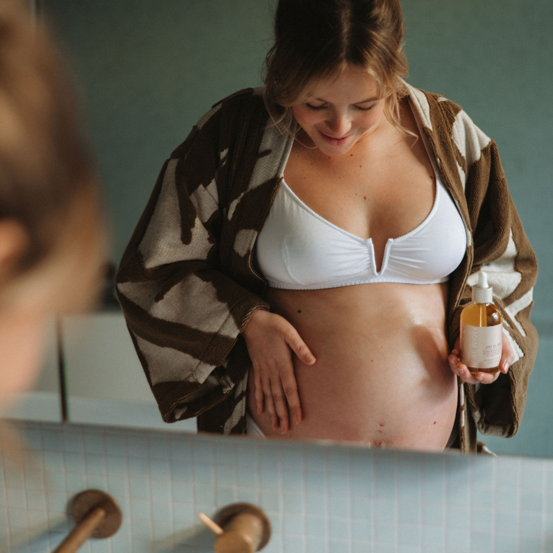 ways to avoid stretch marks