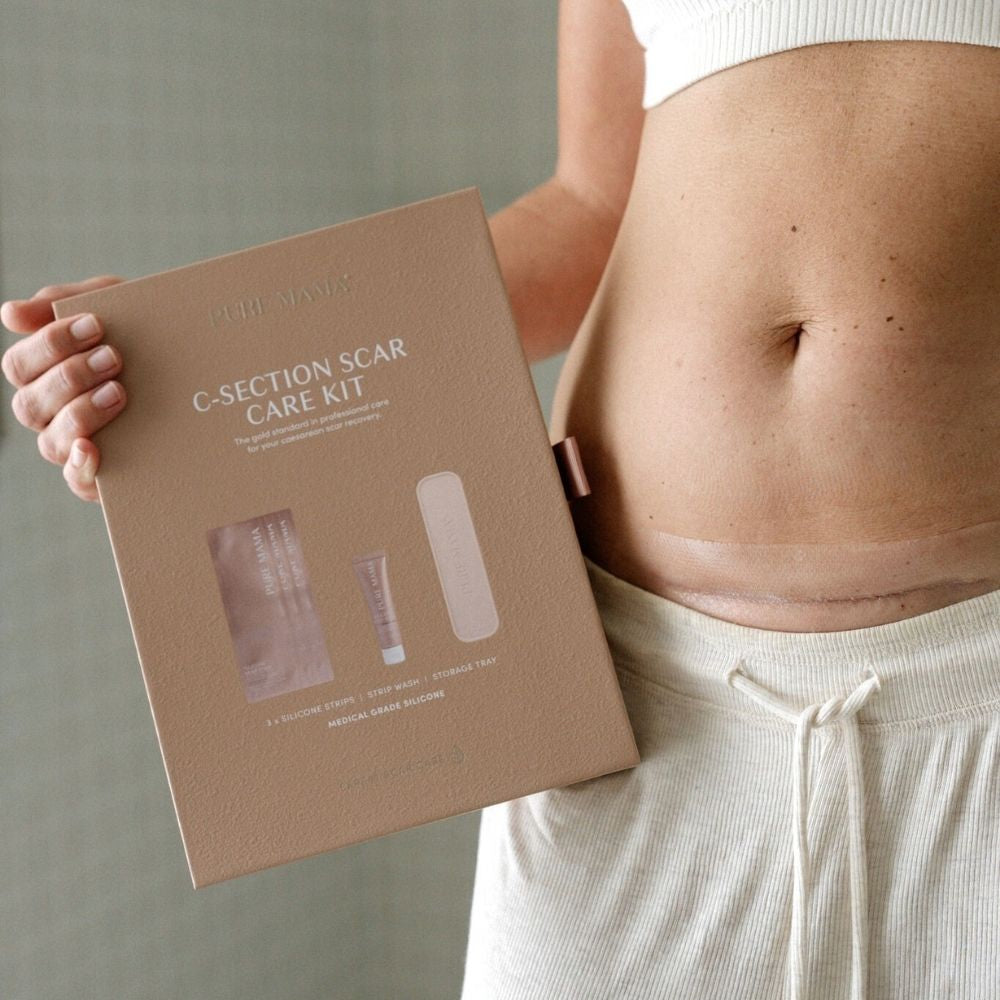 NEW C-Section Scar Care Kit