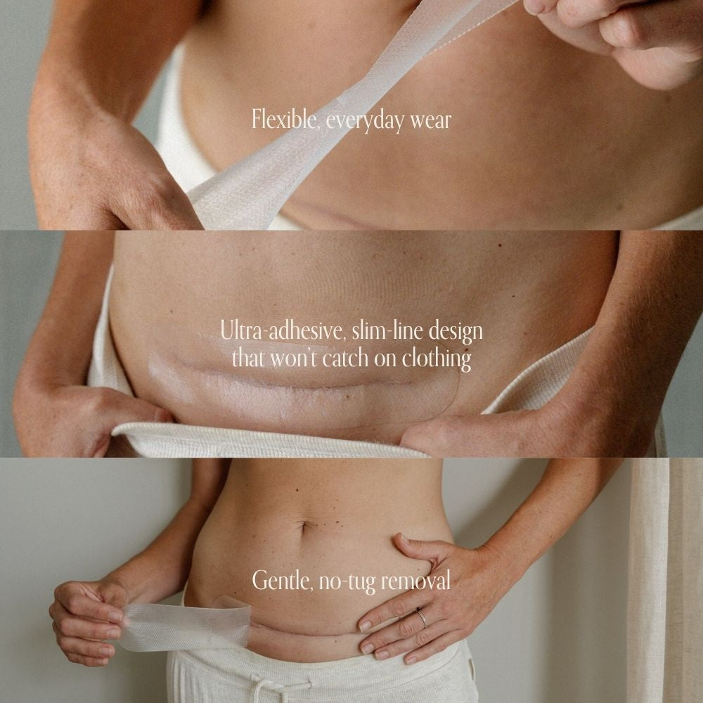 NEW C-Section Scar Care Kit