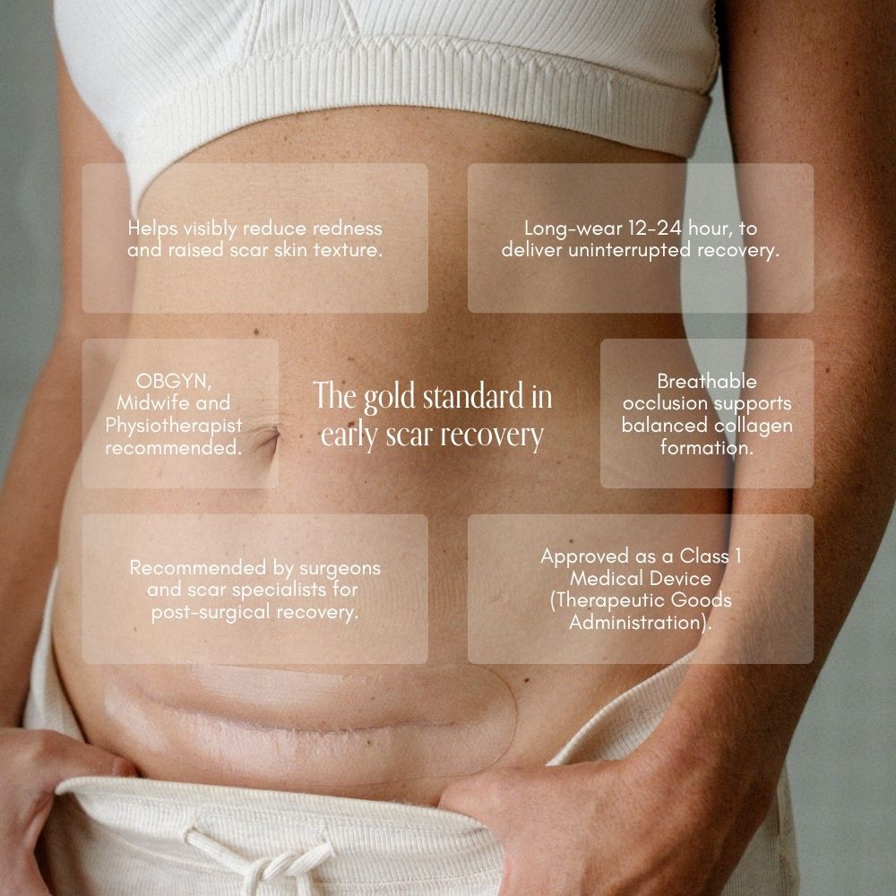 NEW C-Section Scar Care Kit