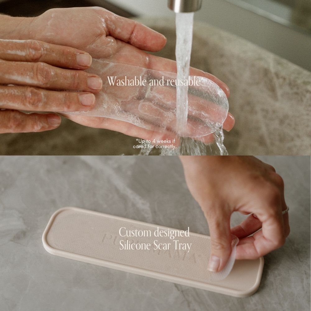 NEW C-Section Scar Care Kit