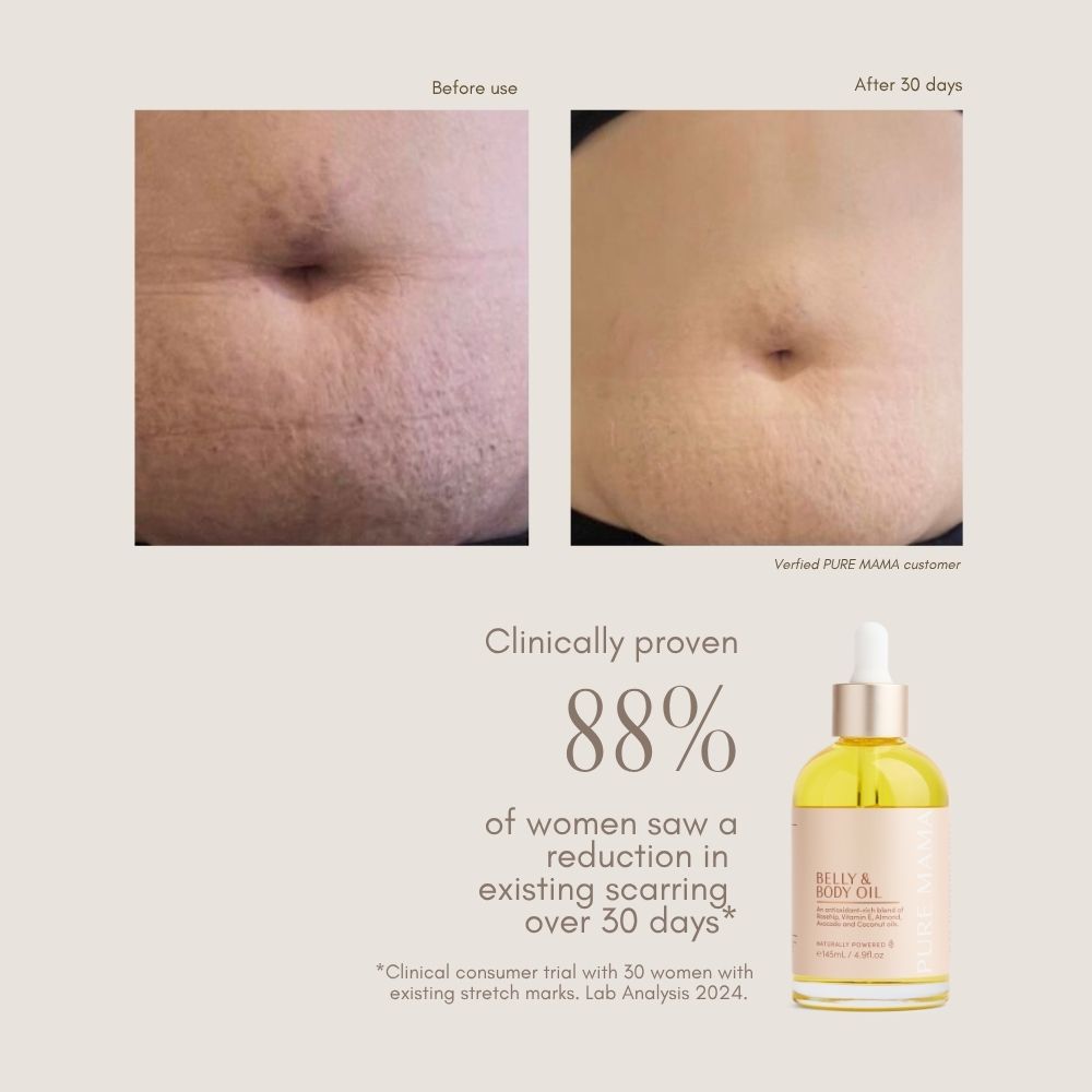 Belly & Body Oil
