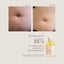 Bump Love Set