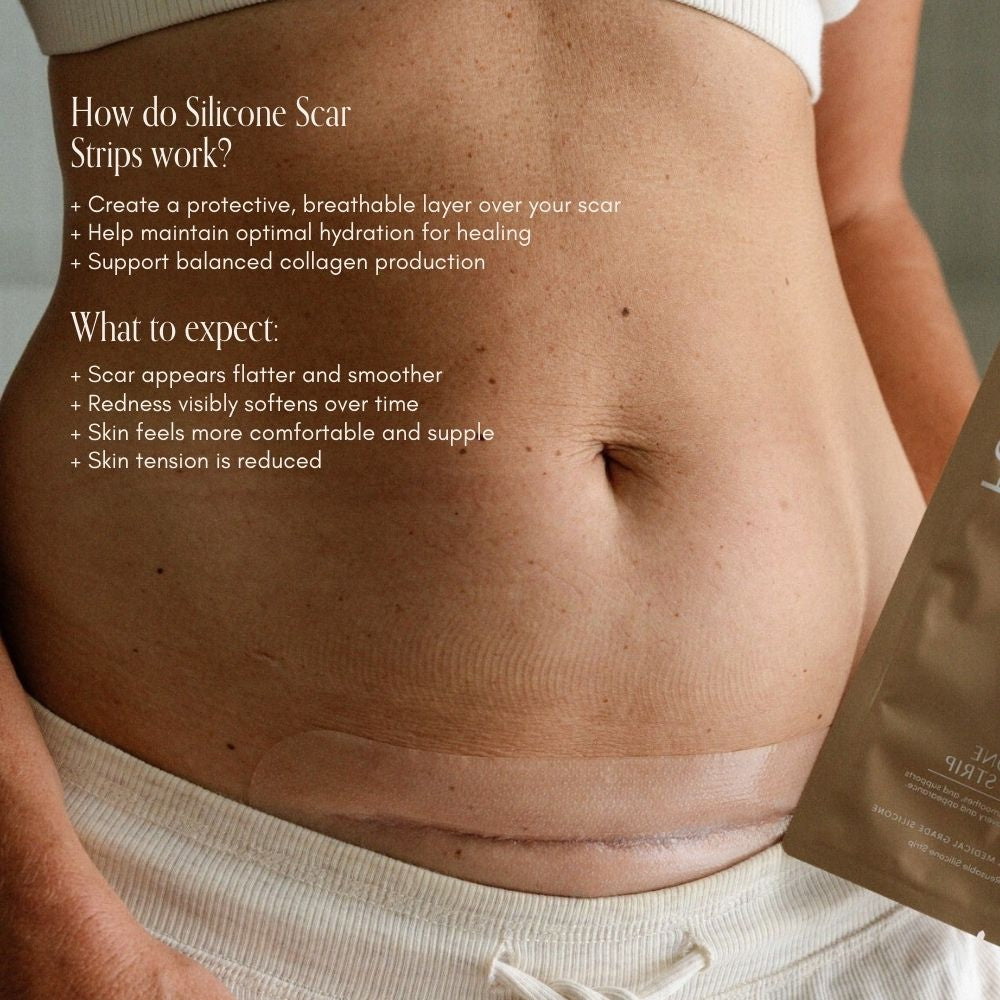 C-Section Scar Recovery BUNDLE