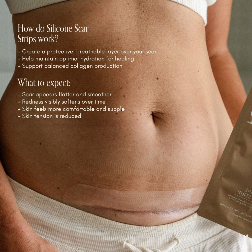 NEW C-Section Scar Care Kit