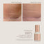 C-Section Scar Recovery BUNDLE